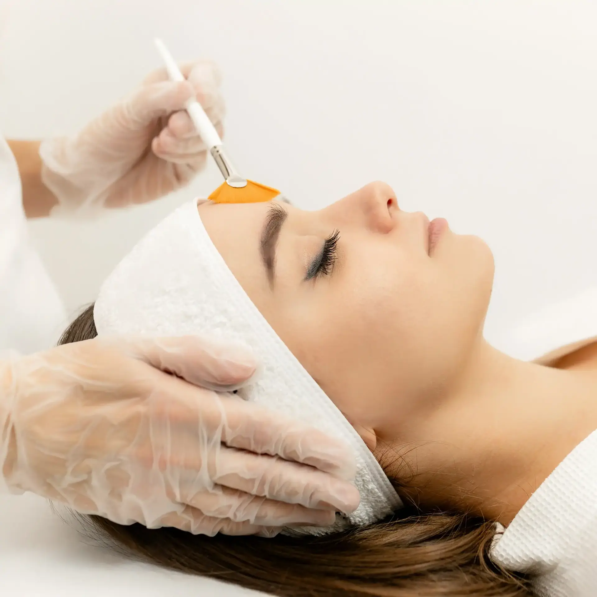 Chemical peel treatment at Rev Med Spa