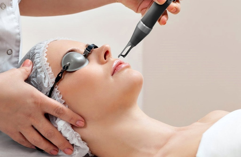 Laser facial treatment at Rev Med Spa