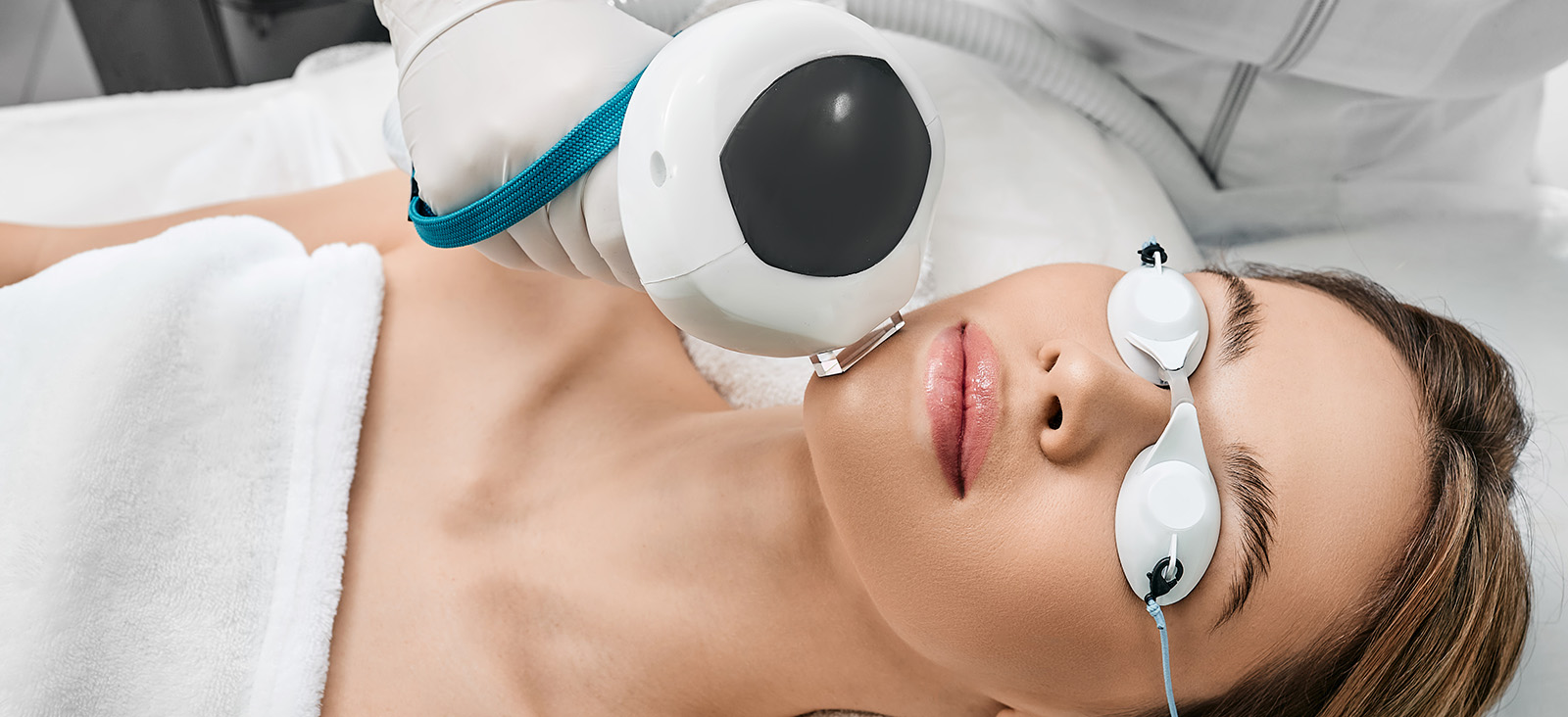 IPL photofacial for pigmentation at Rev Med Spa