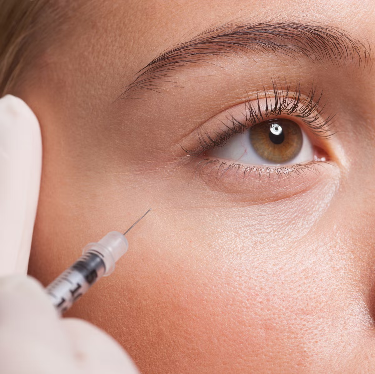 Woman with softened expression lines after Botox at Rev Med Spa